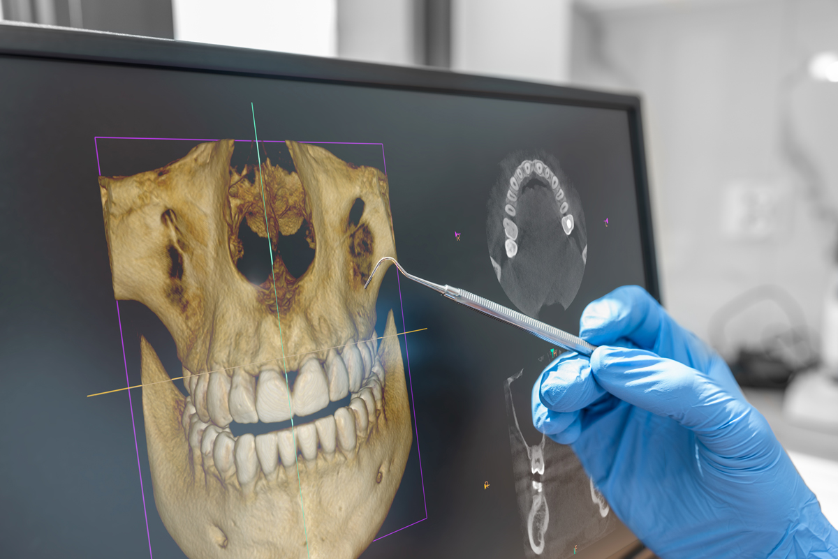 Dental Exam showing image og the skull area