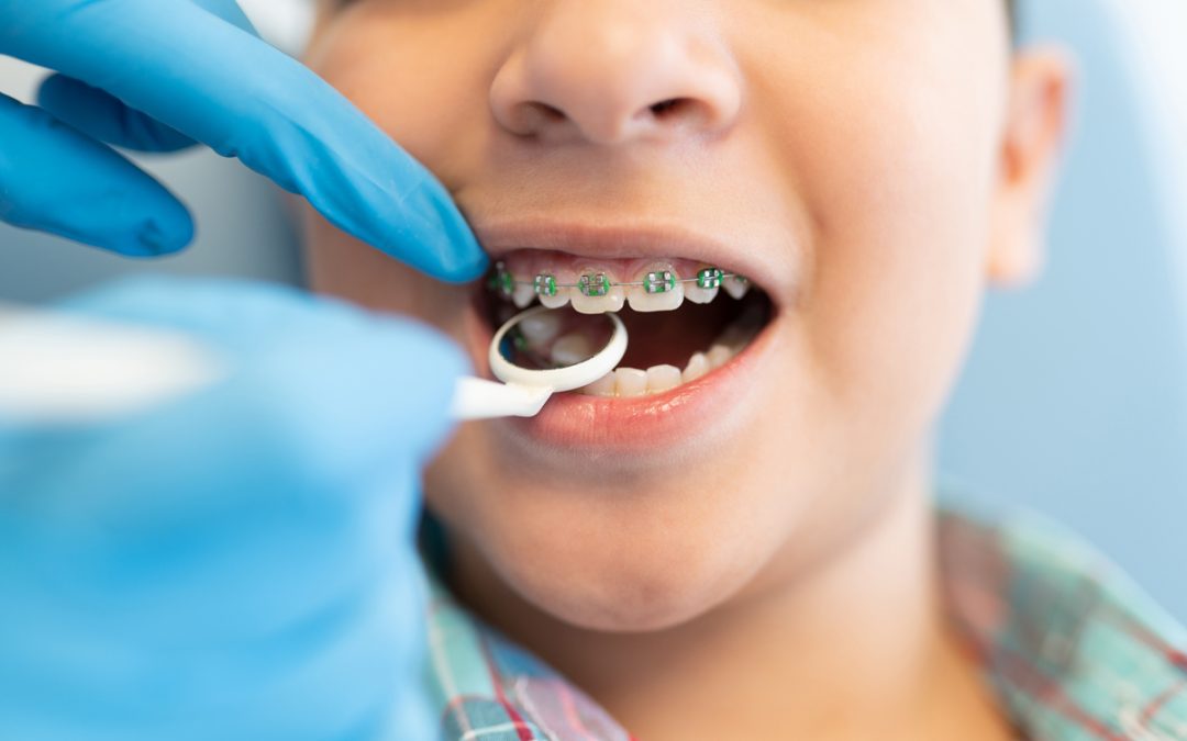 Bite Correction & Orthodontics