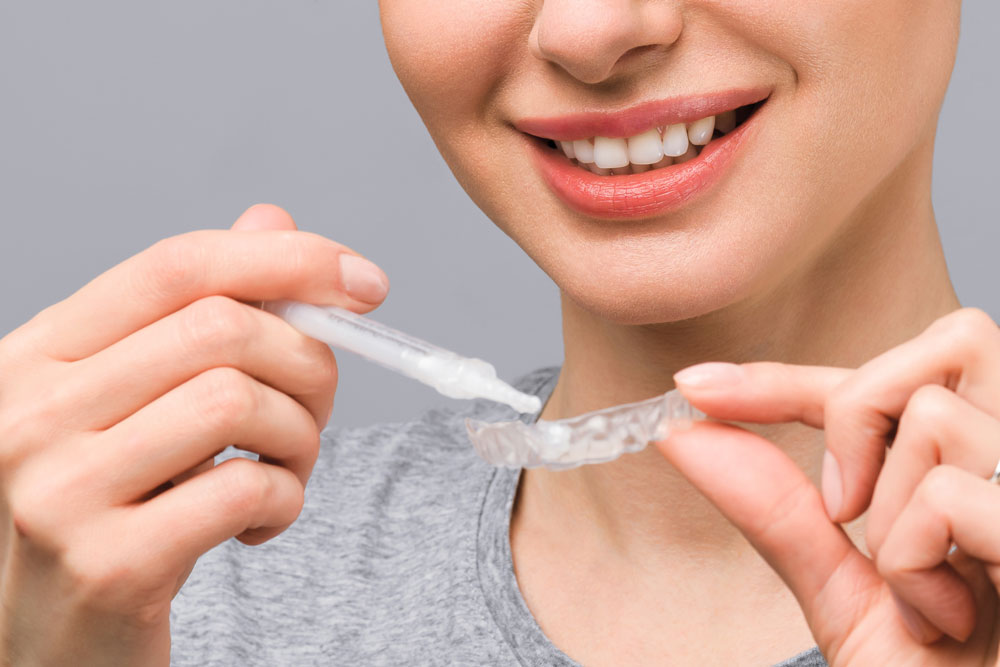 Cosmetic teeth whitening with trays