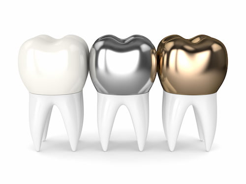 Dental-Crowns Parr Dental