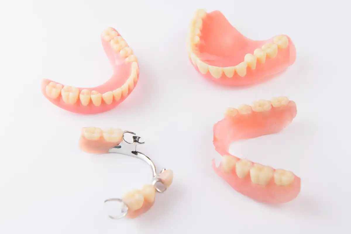 Types of Dentures and Dental Implants