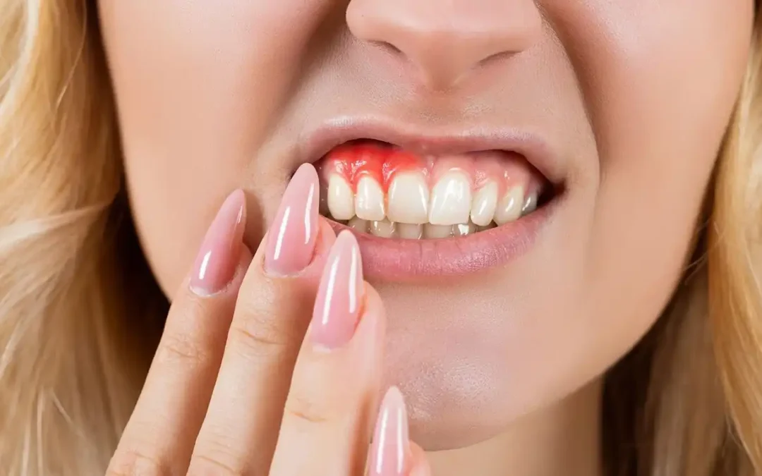 Periodontal Care