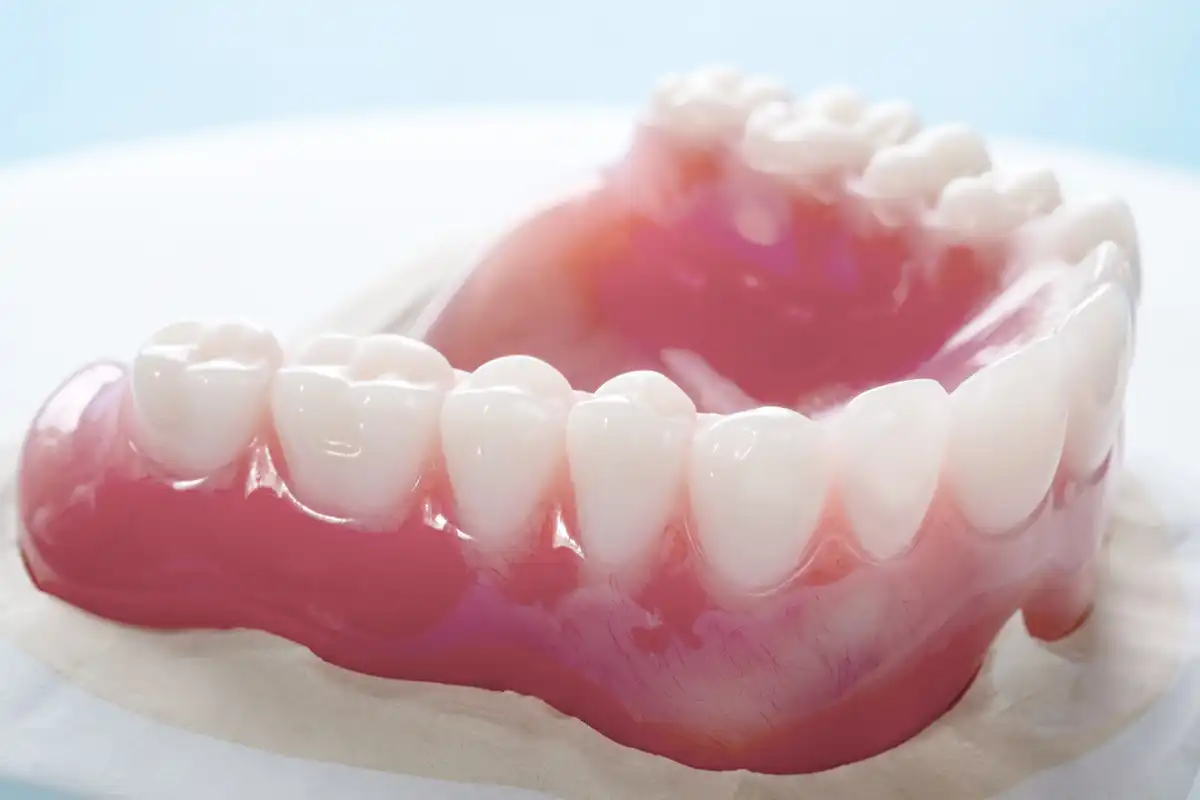 Types of Dentures bottom Dentures