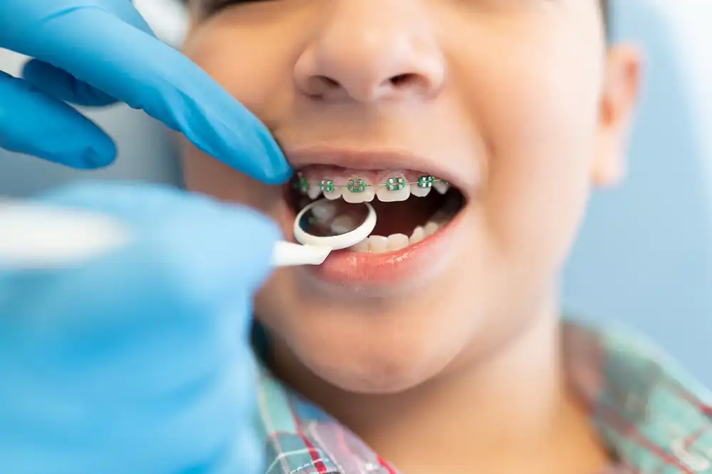 Bite Correction & Orthodontics