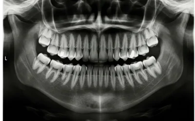 See the Big Picture: Why Panorex Imaging at Parr Dental Offers a Superior Look at Your Oral Health